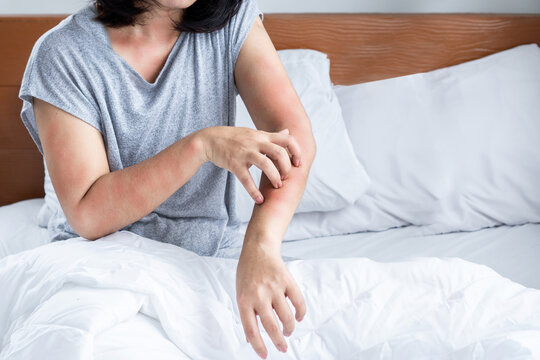 allergy treatment for mattress